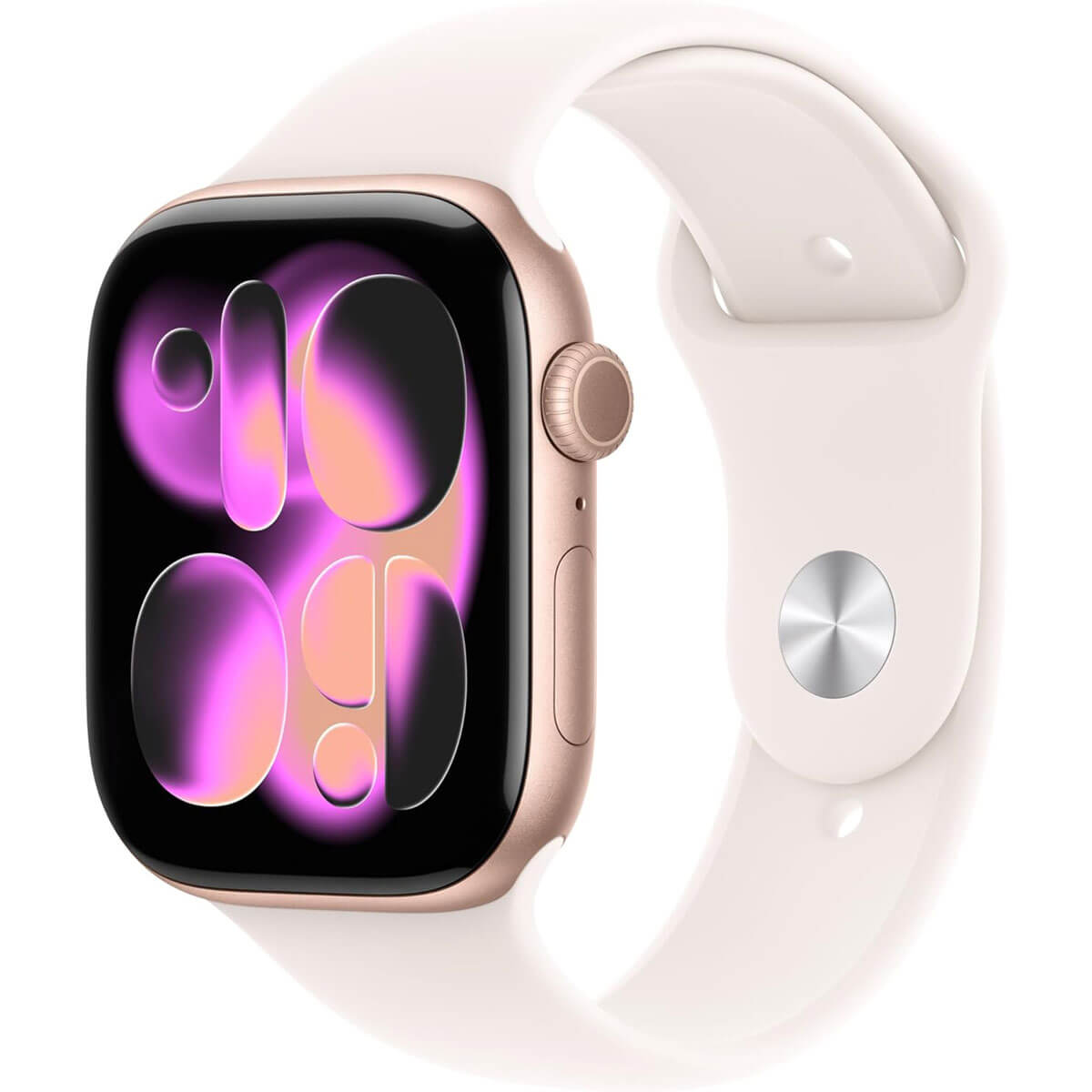 His and Hers Apple Watches - Image 3